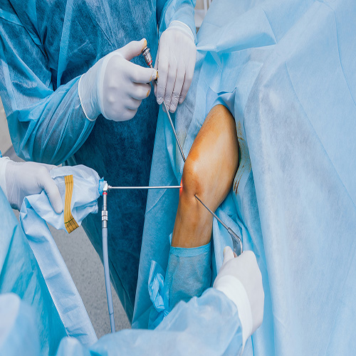 Arthroscopic Surgeries