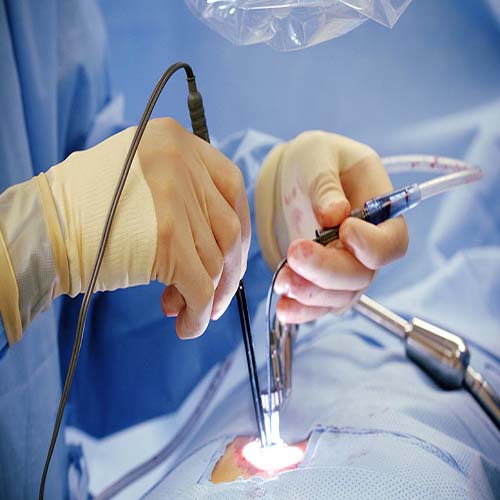 Minimally Invasive Surgery