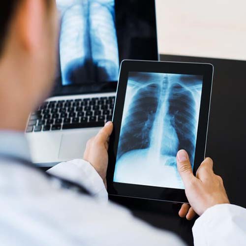 digital X-rays in near me